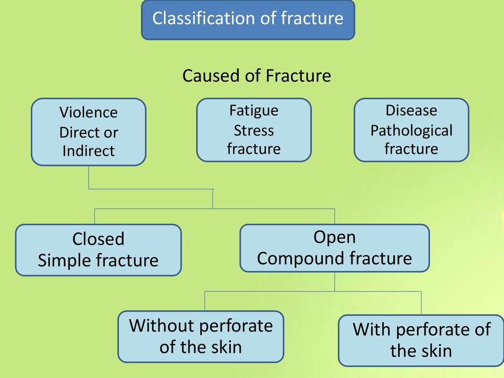 Classification of fracture