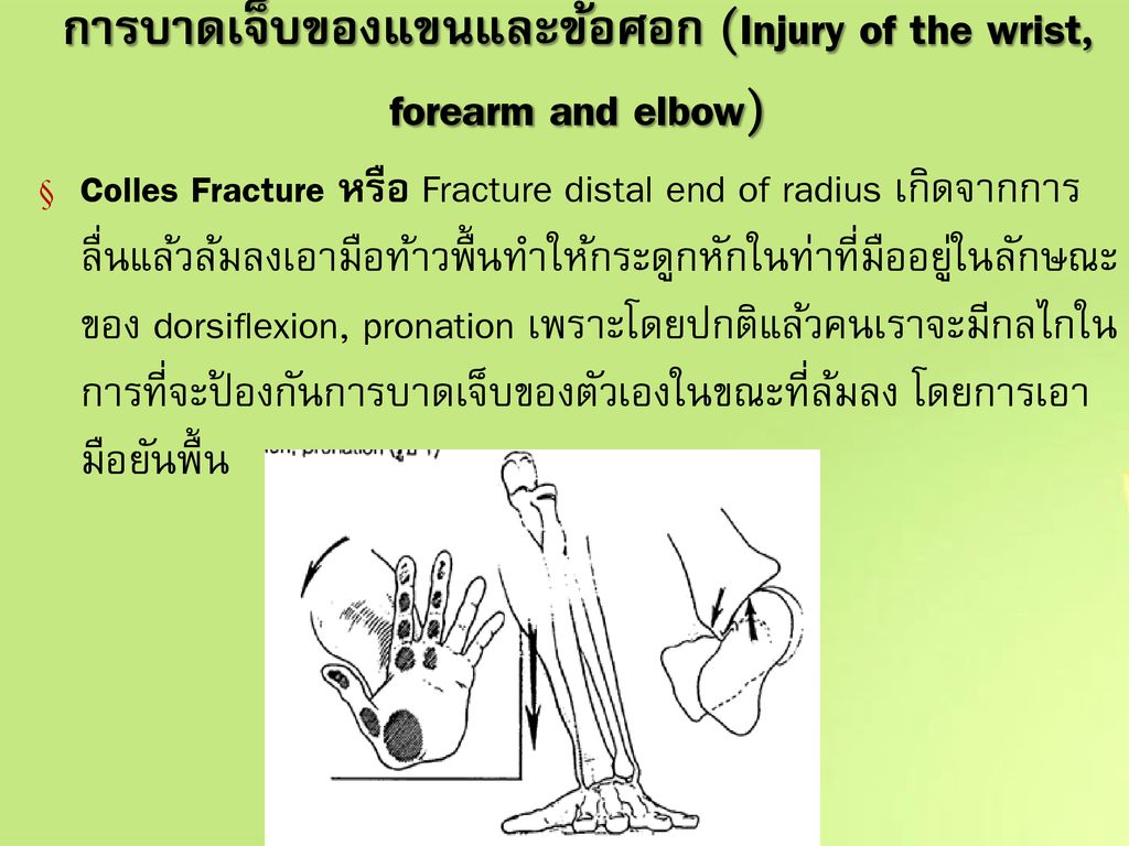 การบาดเจ็บของแขนและข้อศอก (Injury of the wrist, forearm and elbow)