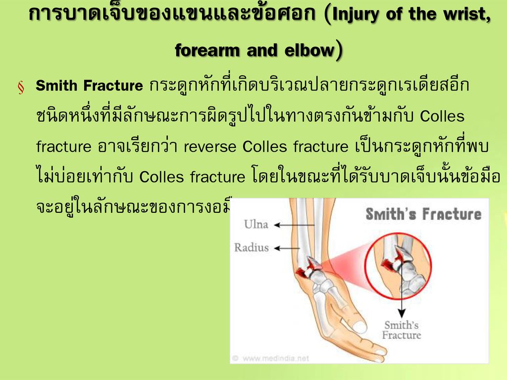 การบาดเจ็บของแขนและข้อศอก (Injury of the wrist, forearm and elbow)