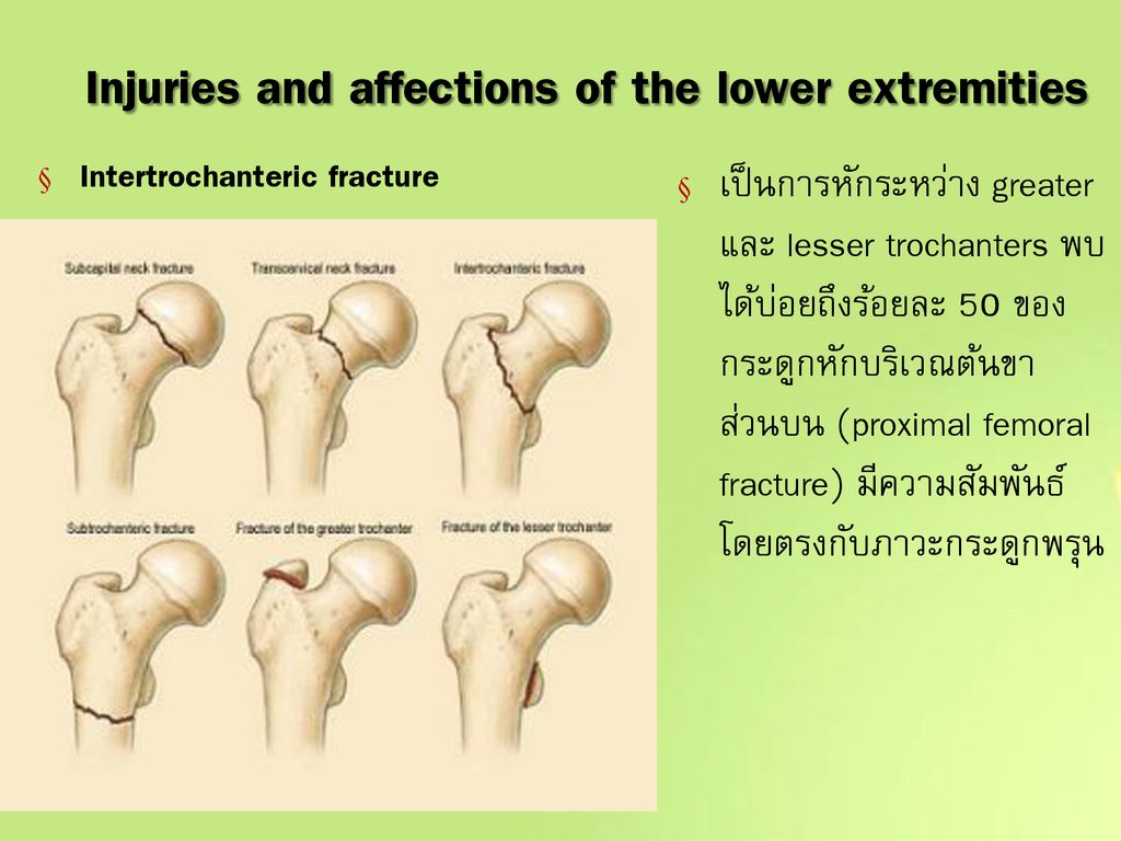 Injuries and affections of the lower extremities