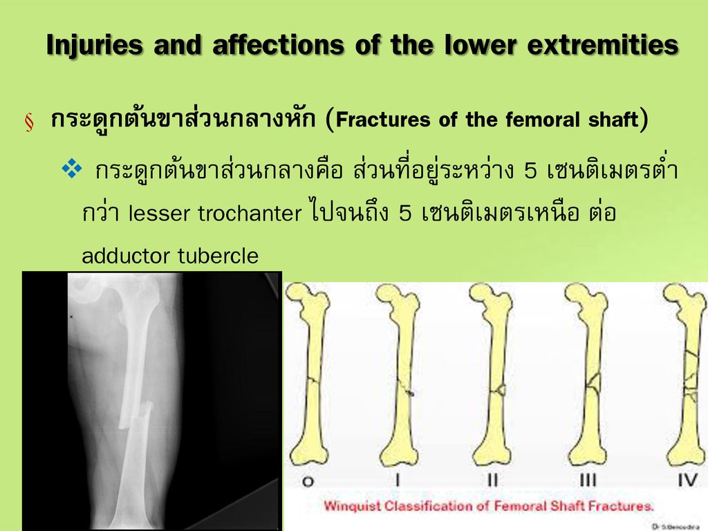 Injuries and affections of the lower extremities