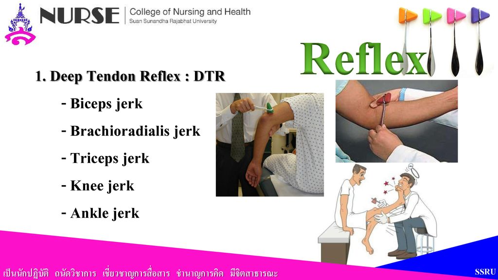 Reflex 1. Deep Tendon Reflex : DTR - Biceps jerk