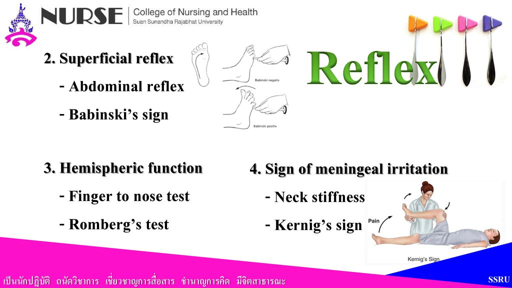 Reflex 2. Superficial reflex - Abdominal reflex - Babinski’s sign