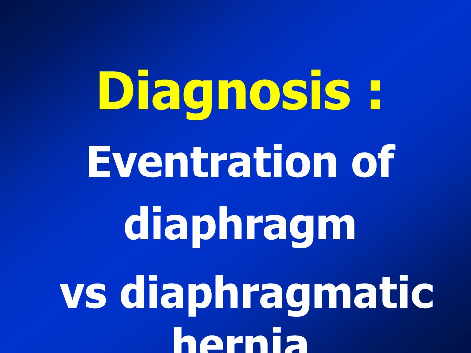 Eventration of diaphragm vs diaphragmatic hernia