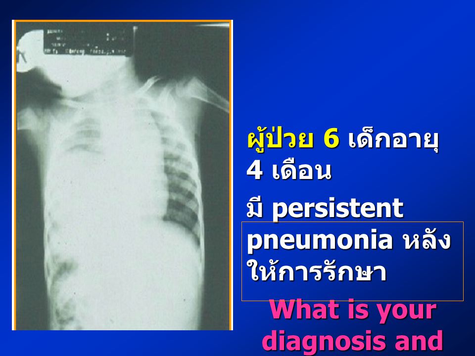 What is your diagnosis and plan of management