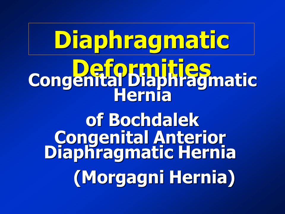 Diaphragmatic Deformities