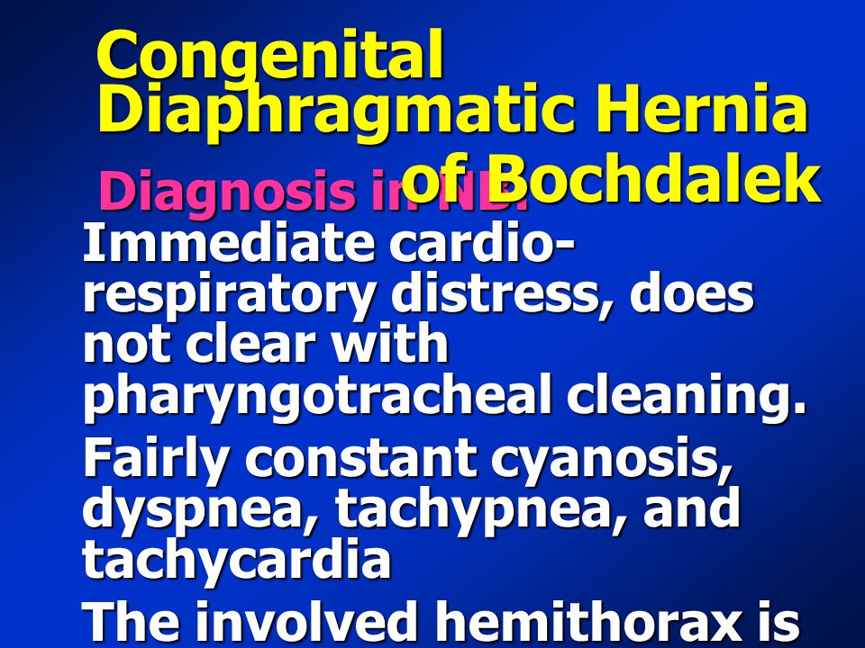Congenital Diaphragmatic Hernia of Bochdalek