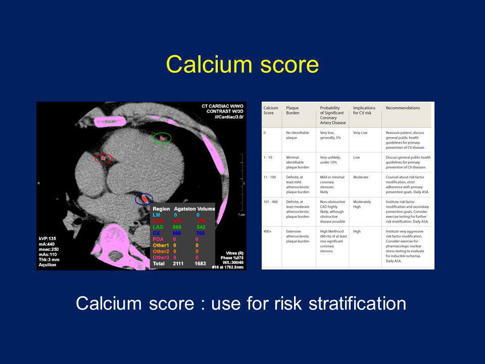 Calcium score Calcium score : use for risk stratification