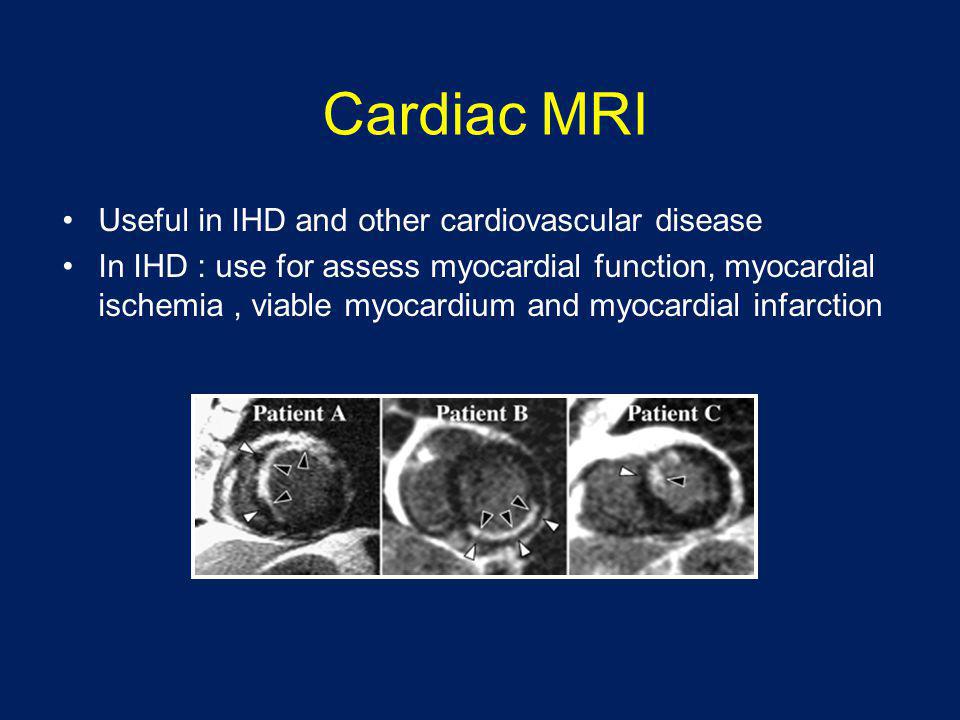 Cardiac MRI Useful in IHD and other cardiovascular disease