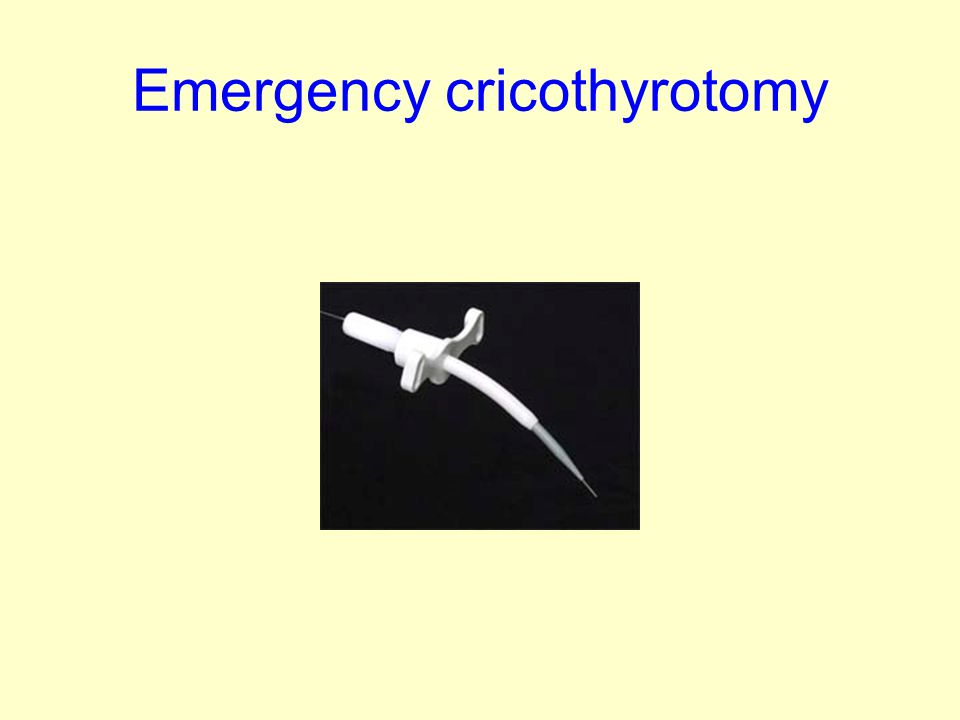 Emergency cricothyrotomy