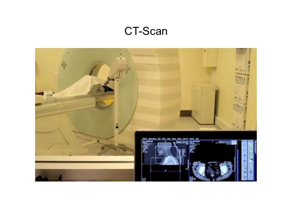 CT-Scan