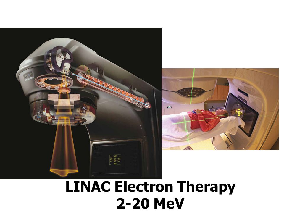 LINAC Electron Therapy
