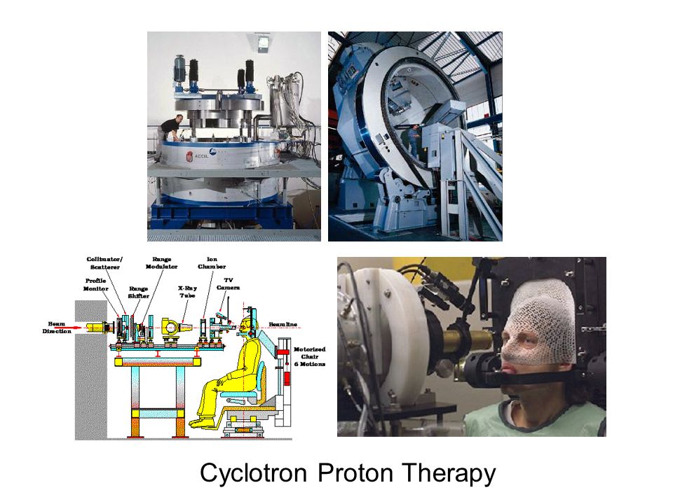 Cyclotron Proton Therapy