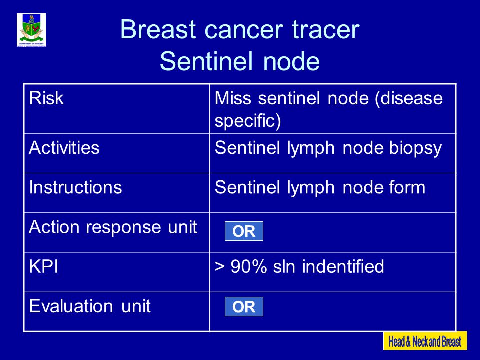 Breast cancer tracer Sentinel node