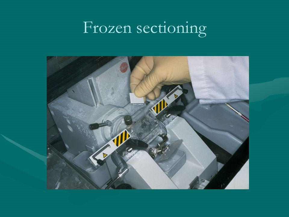 Frozen sectioning