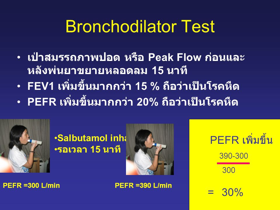 Bronchodilator Test เป่าสมรรถภาพปอด หรือ Peak Flow ก่อนและหลังพ่นยาขยายหลอดลม 15 นาที FEV1 เพิ่มขึ้นมากกว่า 15 % ถือว่าเป็นโรคหืด.