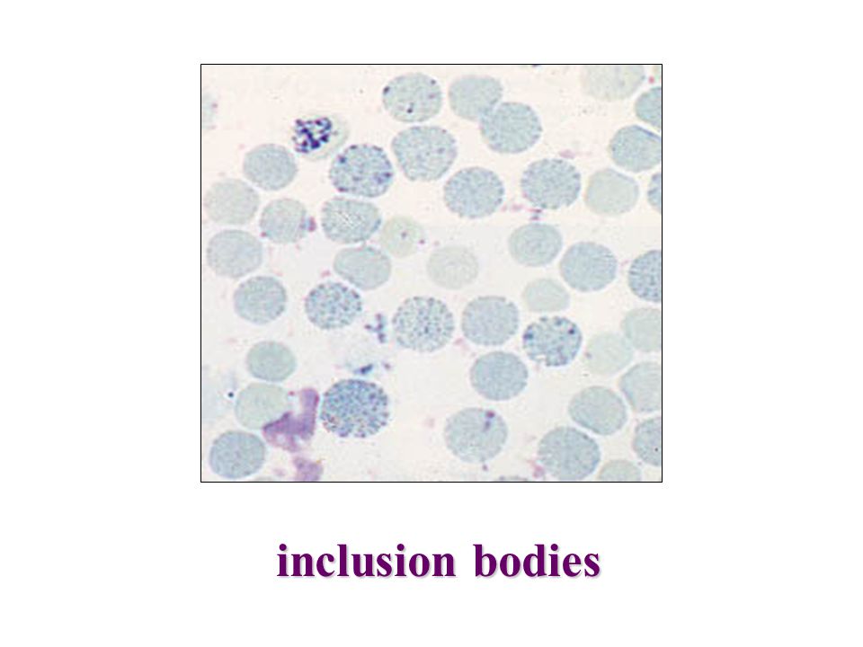 inclusion bodies
