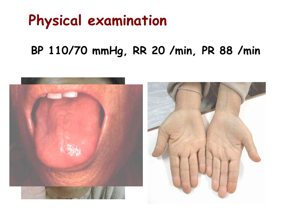 Physical examination BP 110/70 mmHg, RR 20 /min, PR 88 /min