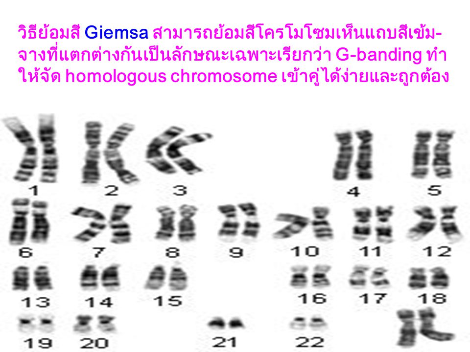 วิธีย้อมสี Giemsa สามารถย้อมสีโครโมโซมเห็นแถบสีเข้ม-จางที่แตกต่างกันเป็นลักษณะเฉพาะเรียกว่า G-banding ทำให้จัด homologous chromosome เข้าคู่ได้ง่ายและถูกต้อง