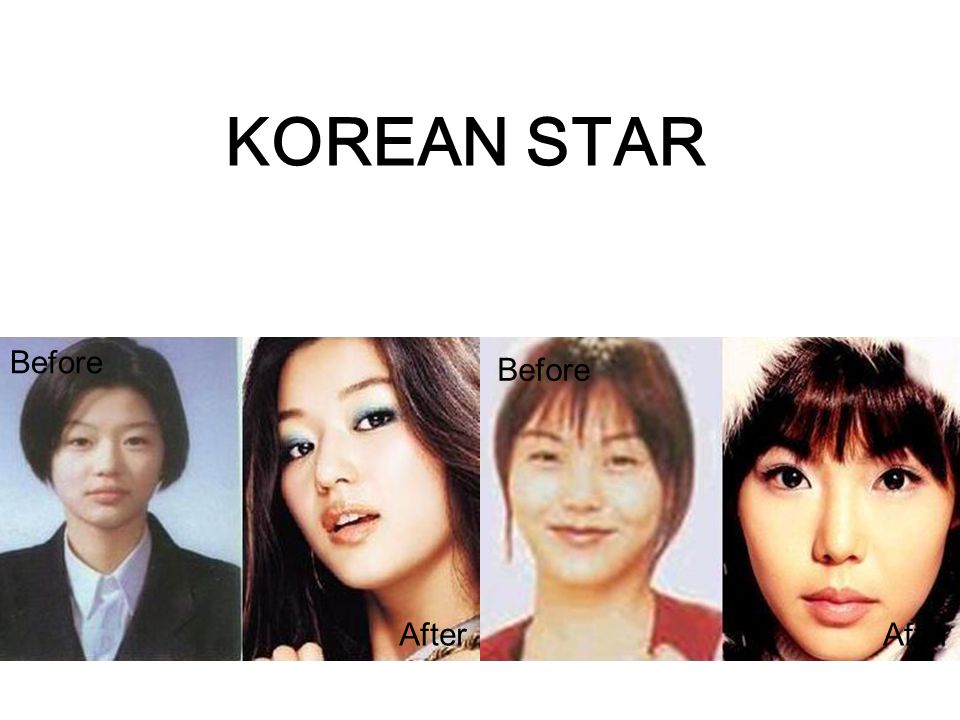 KOREAN STAR Before Before After After