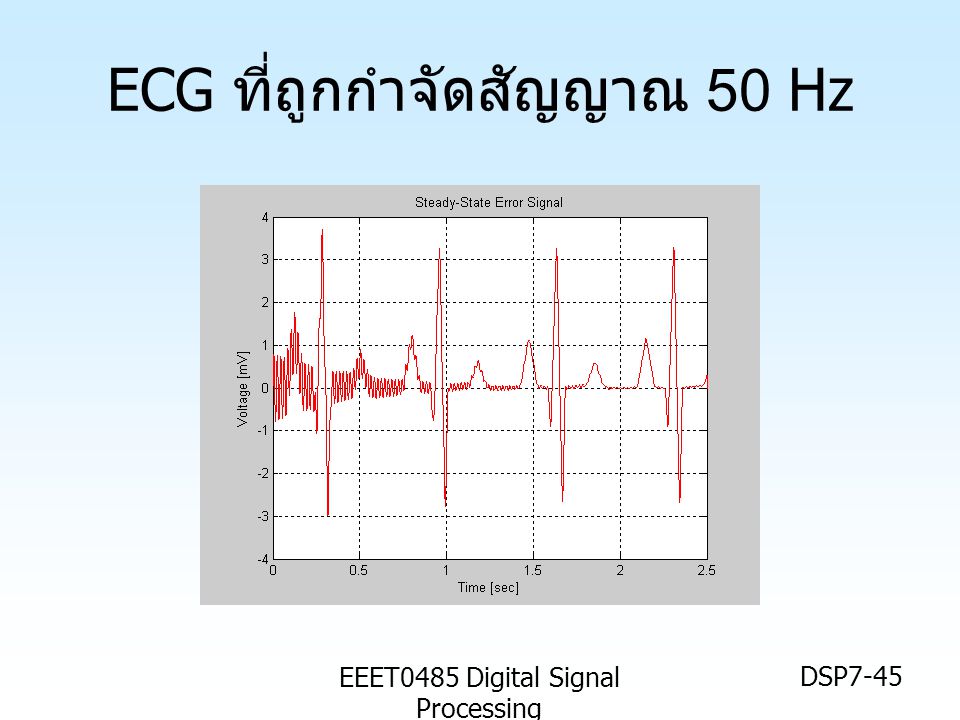 ECG ที่ถูกกำจัดสัญญาณ 50 Hz