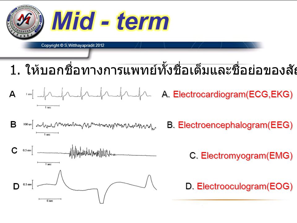 Mid - term Copyright © S.Witthayapradit ให้บอกชื่อทางการแพทย์ทั้งชื่อเต็มและชื่อย่อของสัญญาณขั้วไฟฟ้าดังต่อไปนี้