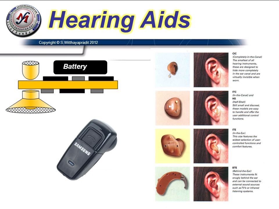Hearing Aids Copyright © S.Witthayapradit 2012 Battery