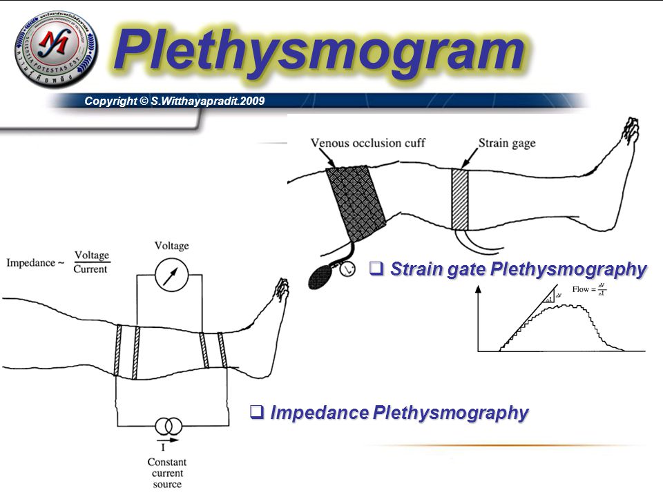 Strain gate Plethysmography Impedance Plethysmography