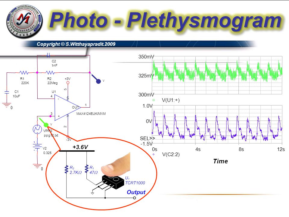 Photo - Plethysmogram Time 0s 4s 8s 12s V(C2:2) 0V 1.0V -1.5V