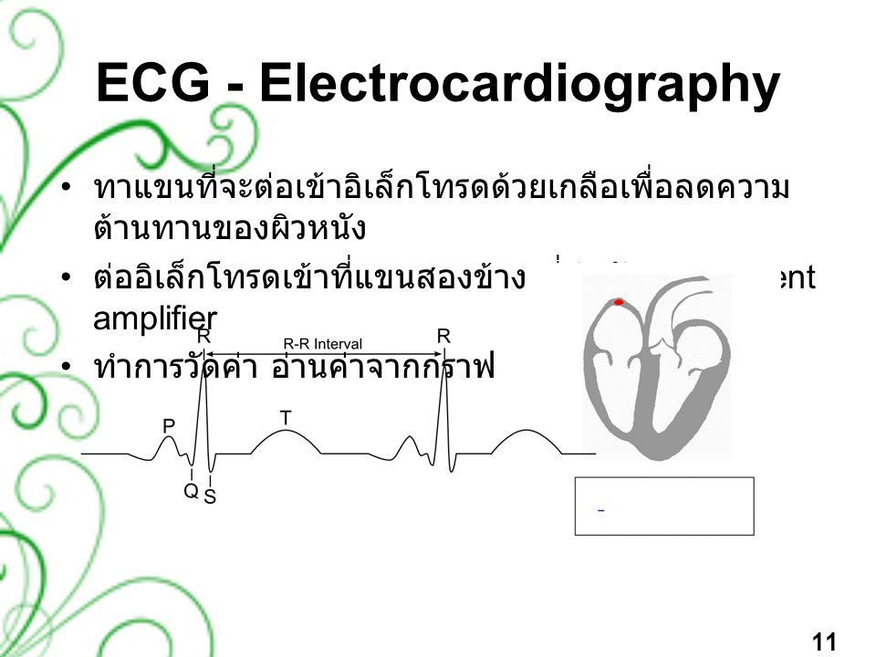 ECG - Electrocardiography