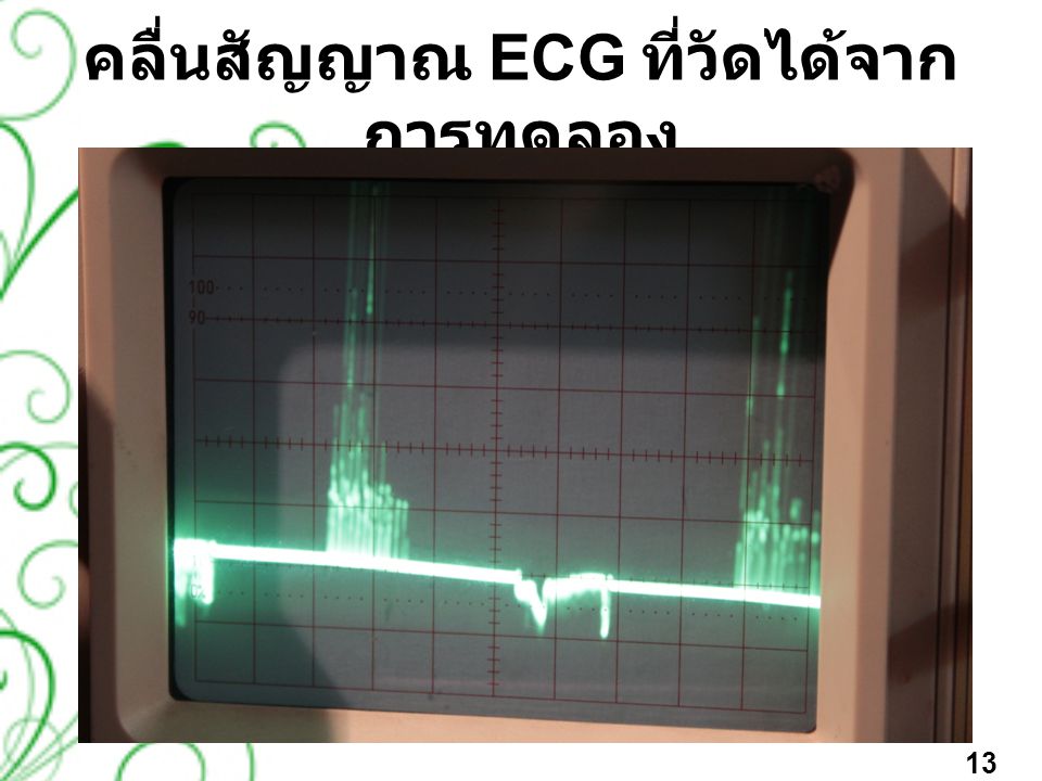 คลื่นสัญญาณ ECG ที่วัดได้จากการทดลอง