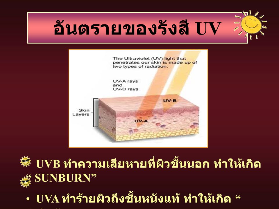 อันตรายของรังสี UV UVB ทำความเสียหายที่ผิวชั้นนอก ทำให้เกิด SUNBURN