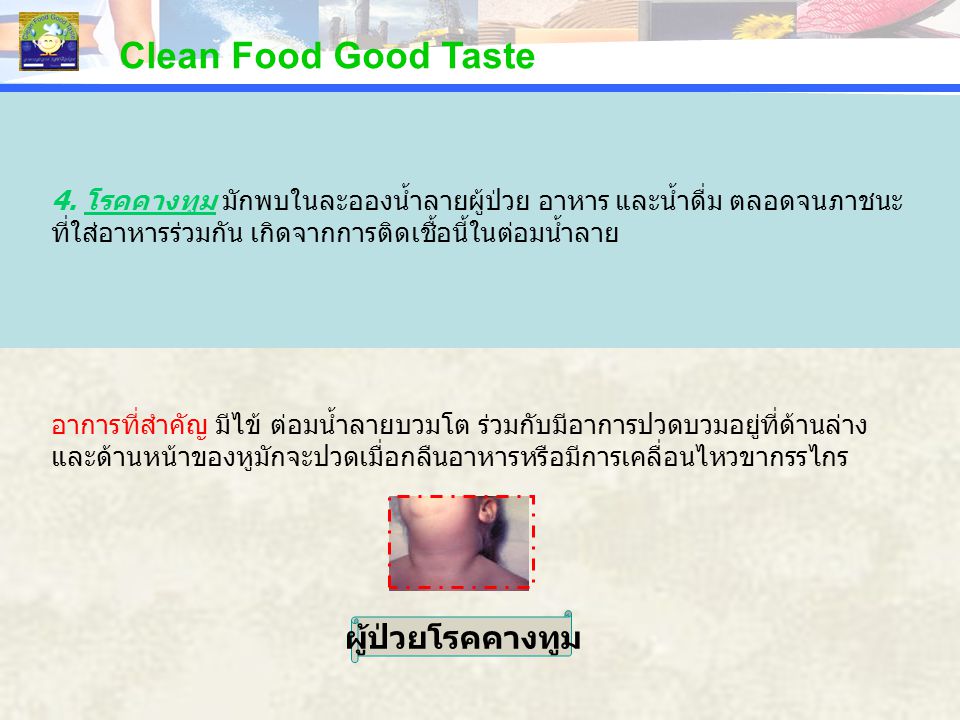 Clean Food Good Taste ผู้ป่วยโรคคางทูม
