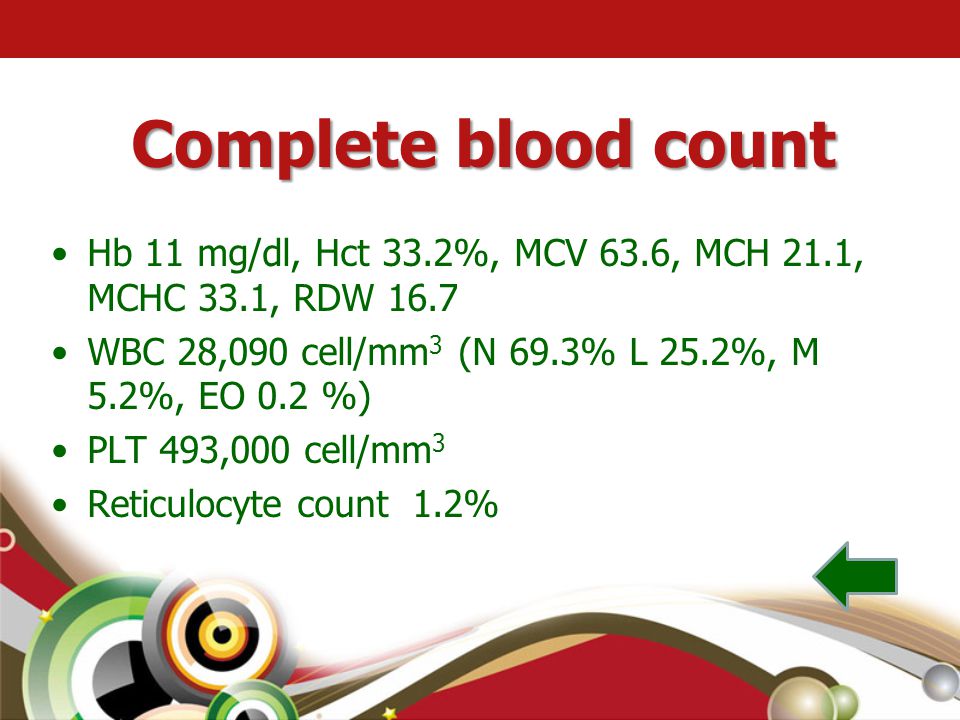 Complete blood count Hb 11 mg/dl, Hct 33.2%, MCV 63.6, MCH 21.1, MCHC 33.1, RDW WBC 28,090 cell/mm3 (N 69.3% L 25.2%, M 5.2%, EO 0.2 %)