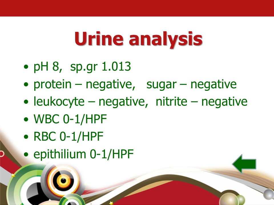 Urine analysis pH 8, sp.gr protein – negative, sugar – negative