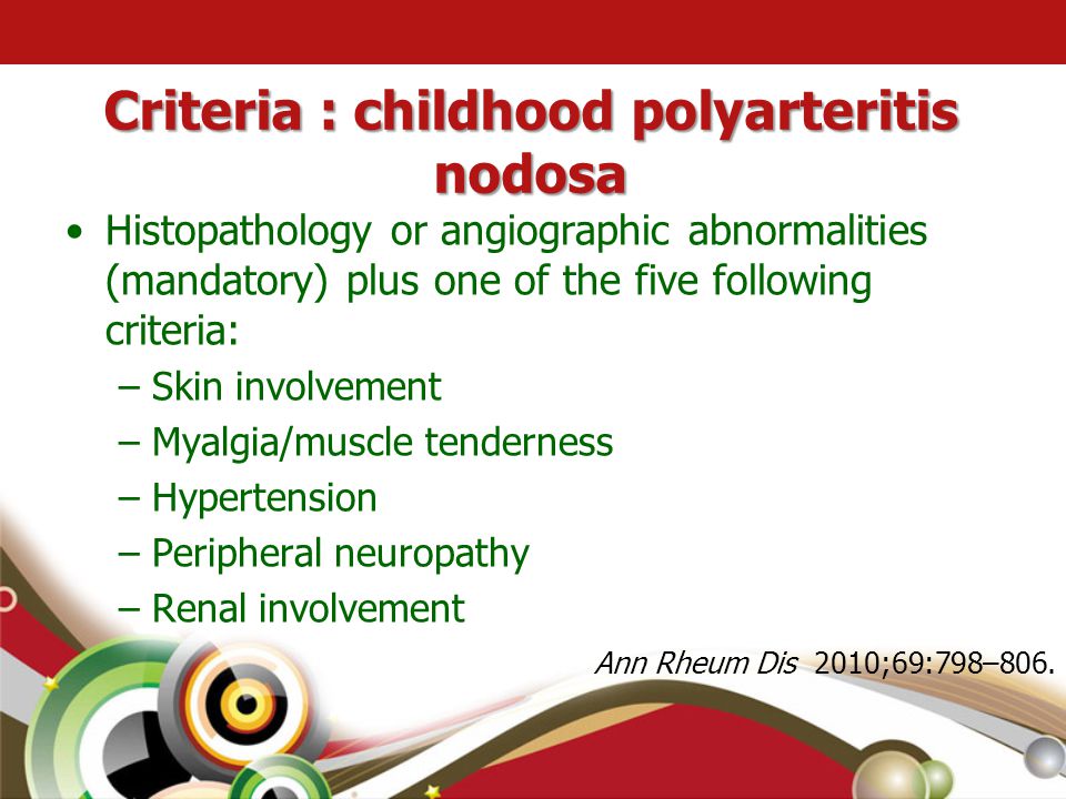 Criteria : childhood polyarteritis nodosa