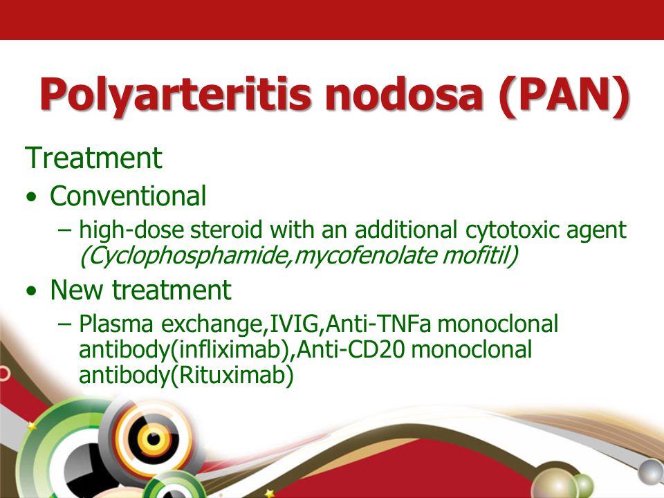 Polyarteritis nodosa (PAN)