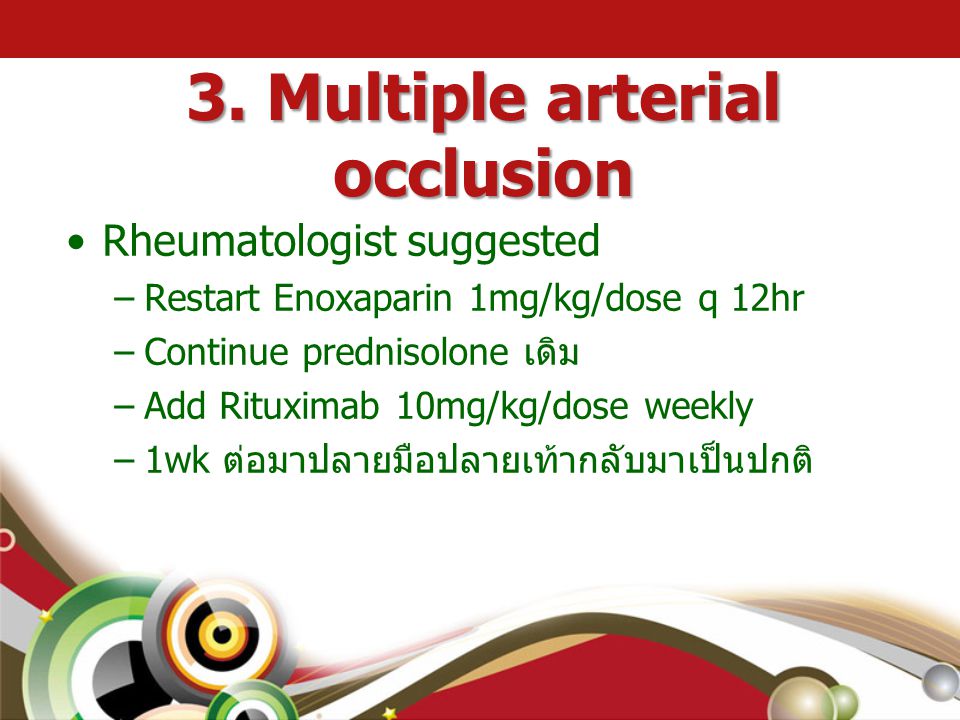 3. Multiple arterial occlusion