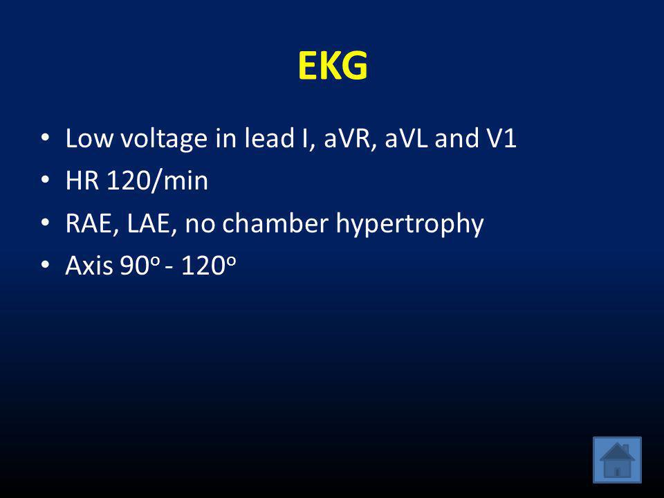 EKG Low voltage in lead I, aVR, aVL and V1 HR 120/min