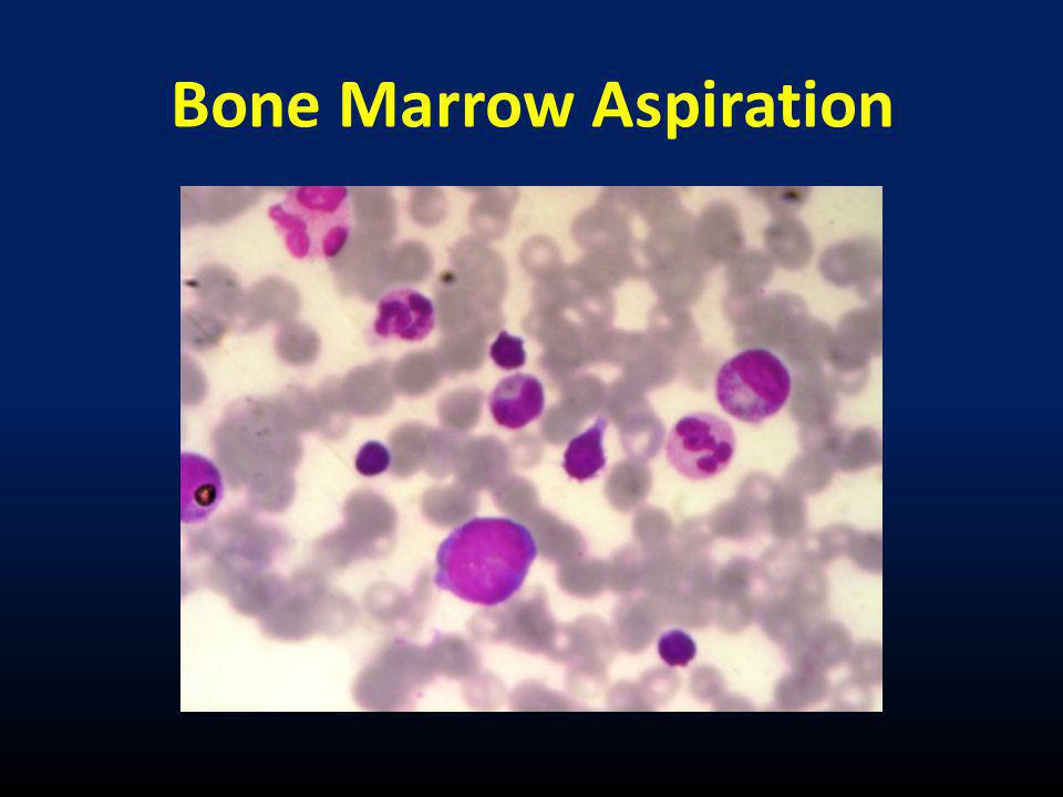 Bone Marrow Aspiration