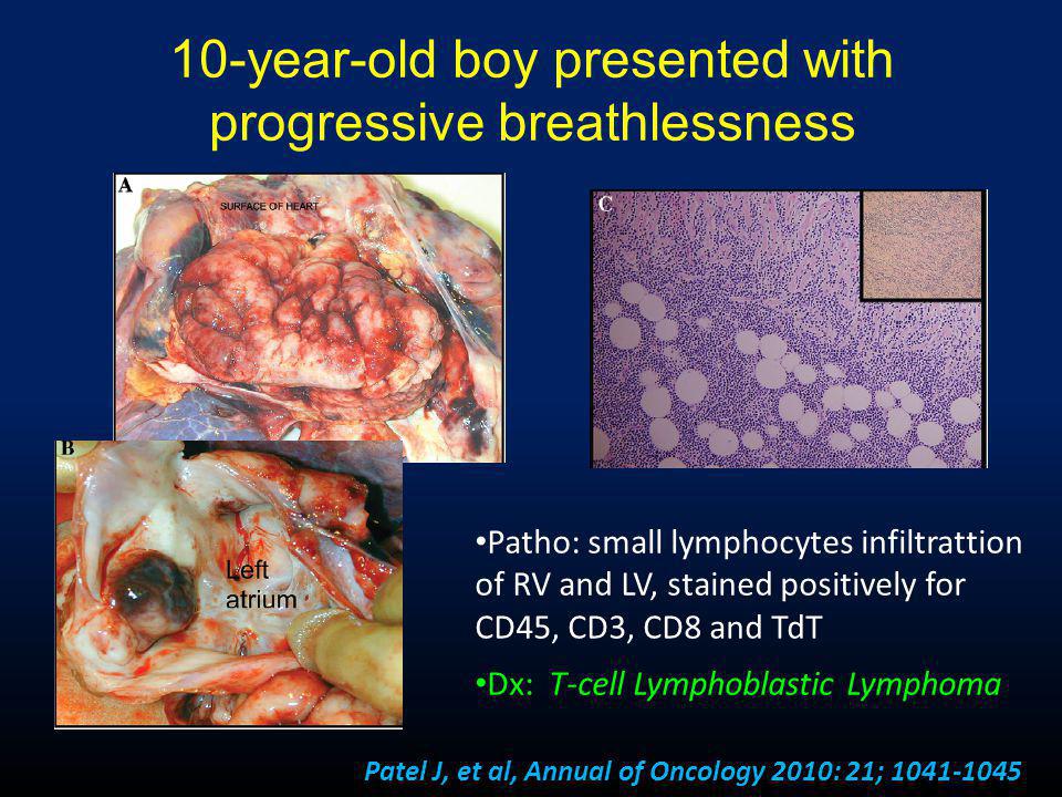 10-year-old boy presented with progressive breathlessness