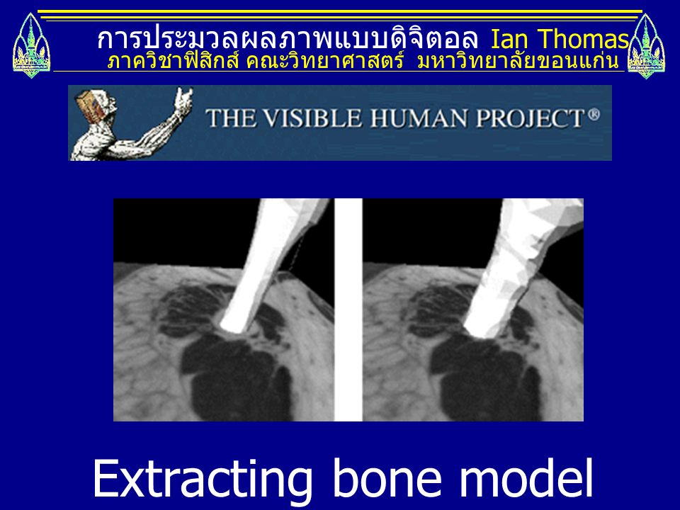 Extracting bone model from 3D dataset
