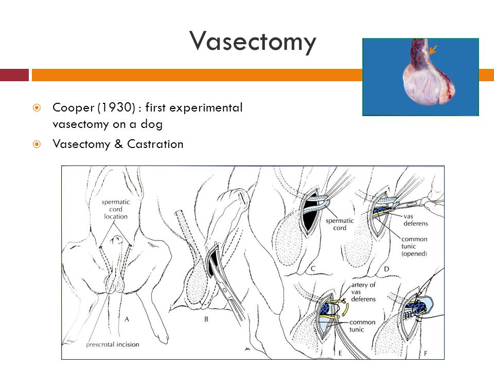 Vasectomy Cooper (1930) : first experimental vasectomy on a dog