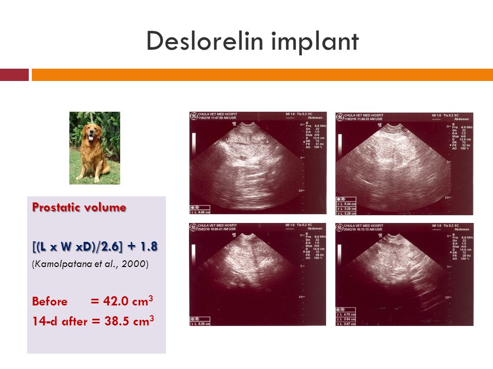Deslorelin implant Prostatic volume [(L x W xD)/2.6] + 1.8