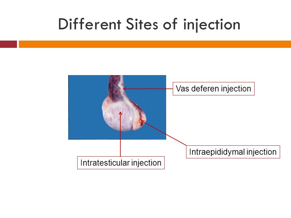 Different Sites of injection