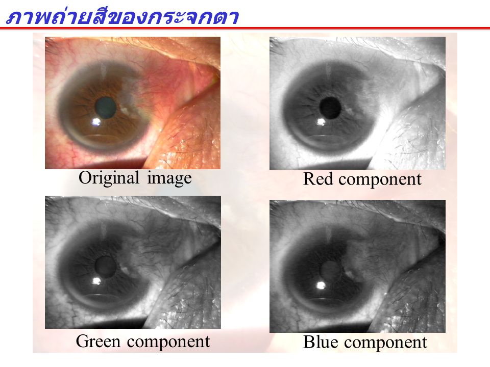ภาพถ่ายสีของกระจกตา Original image Red component Green component