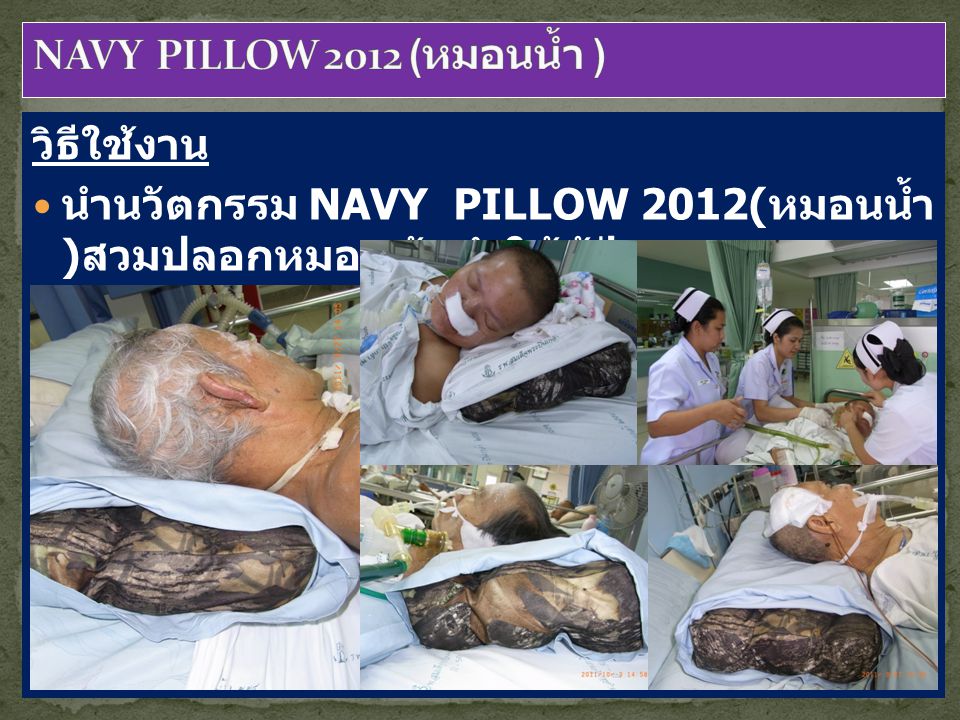 นำนวัตกรรม NAVY PILLOW 2012(หมอนน้ำ )สวมปลอกหมอนผ้า นำให้ ผู้ป่วยหนุน