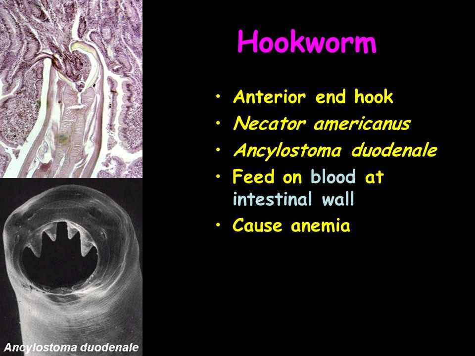 Hookworm Anterior end hook Necator americanus Ancylostoma duodenale