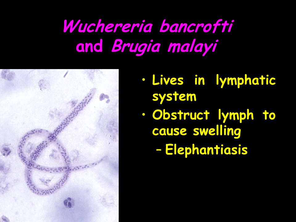 Wuchereria bancrofti and Brugia malayi