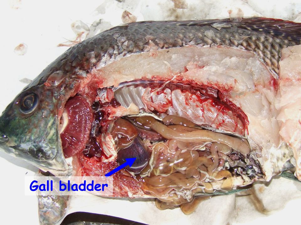 Gall bladder
